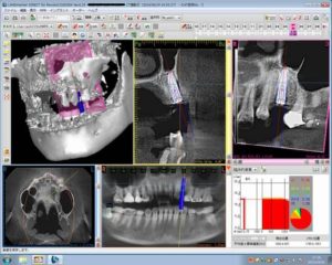 All(MPR)_20150401_172826