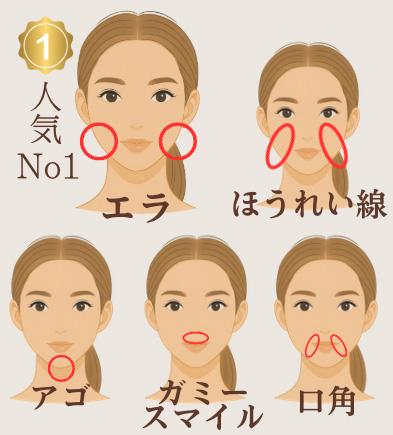 注入箇所部位