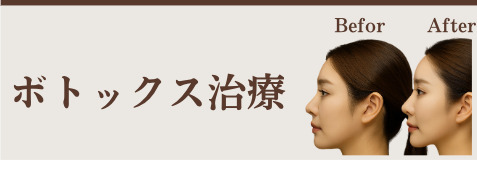 ボトックス治療