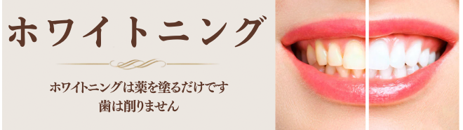 ホワイトニング